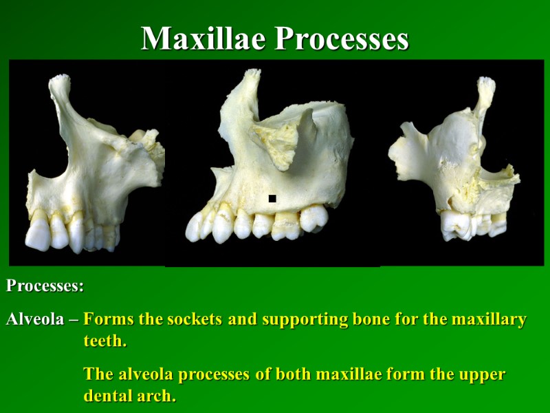 Maxillae Processes   Processes: Alveola – Forms the sockets and supporting bone for